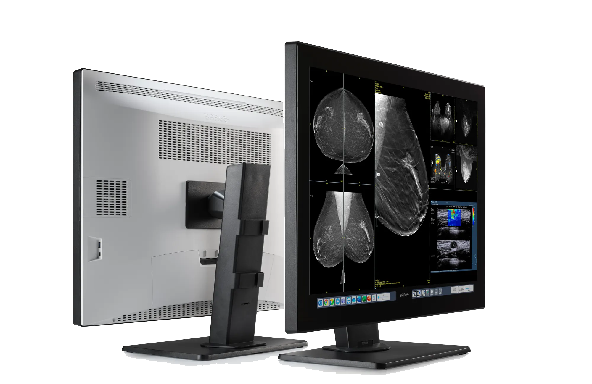 Barco Medical Diagnostic Displays